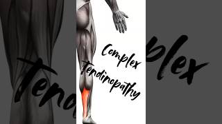 letstalkabout complex tendinopathy sports sportsmedicine sportsdoctor sportsinjury fyp [upl. by Nathan741]