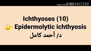 10 Epidermolytic ichthyosis [upl. by Rednaxela]