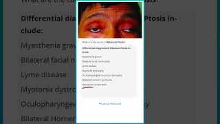 Causes of Bilateral Ptosis [upl. by Levina]