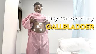 MY LAPAROSCOPIC GALLBLADDER REMOVAL SURGERY  RECOVERY [upl. by Dnaltroc]