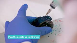 Fresh Tissue Sampling  Fine Needle Aspirate FNA Technique [upl. by Sammons]