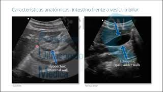 Vías Biliares y Vesícula Anatomia [upl. by Westbrook]