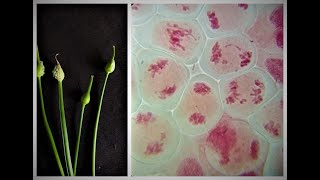 Meiosis in onion flowerbuds experiment [upl. by Egor]