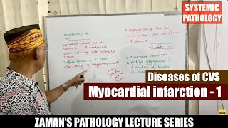 Systemic Pathology Lecture 35  Diseases of CVS  Day 05  Myocardial infarction  01 [upl. by Cira]