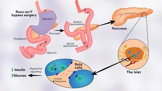 How tyrosine might help regulate glucose levels [upl. by Leach]