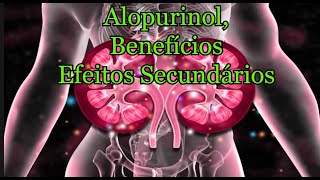 Alopurinol Benefícios efeitos secundários [upl. by Avuha319]