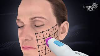 Our Thermage FLX Skin Treatments  HHC Clinics [upl. by Otreblasiul628]