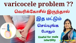 What is Varicocele in tamil  Varicocele Treatment  ஆண் மலட்டுத் தன்மைக்கு சிறந்த தீர்வு DrAswini [upl. by Aleck]