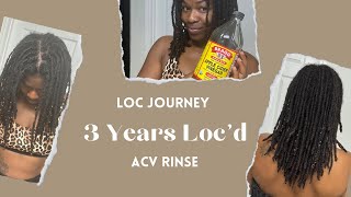 ACV Rinse on Locs  Loc Update  Locs w Alopecia [upl. by Aneehsirk]