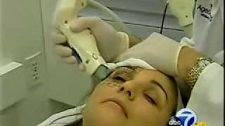 Doctors PR  Eyes by Thermage Eyelid Rejuvenation on TV [upl. by Renny711]