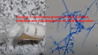 Fungus Trichoderma growth on SDA Conidia phialides and conidiophores in LPCB Preparation [upl. by Dey2]