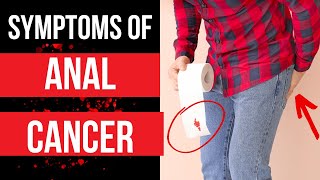 Doctor explains SYMPTOMS OF ANAL CANCER  plus risk factors diagnosis and treatment [upl. by Lyrac]