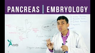 Pancreas Development Congenital Anomalies  বাংলা [upl. by Darcy675]