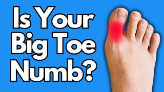 Big Toe Numbness Try THIS For Relief [upl. by Seabury]