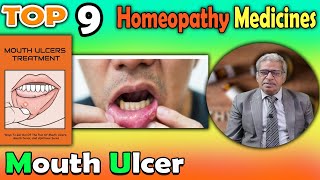 Mouth Ulcer Causes and homeopathy Treatment  Dr P S Tiwari [upl. by Alic132]