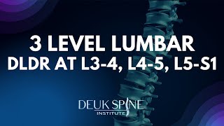 3 Level DLDR at L34 L45 L5S1 of the Lumbar Spine [upl. by Jens507]