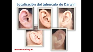 52 Localización del Tubérculo de Darwin Cursos Auriculoterapia Centro IMG [upl. by Tobye241]