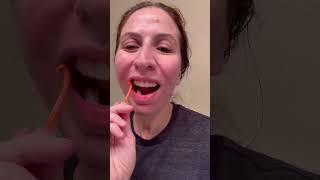 Follow my Invisalign journey  invisalign holisticdentistry [upl. by Everett153]