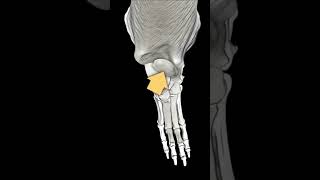 Patellar subluxation in French bulldogs [upl. by Fridlund]