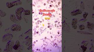 Cardiomyocyte dancing 😜shorts scienceexperiment scienceshorts cardiomyocyte cardiactechnology [upl. by Eneres]