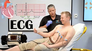 What Is ECG ElectrocardiogramEKG Indications How It Is Done And Basic Principles [upl. by Sucirdor]