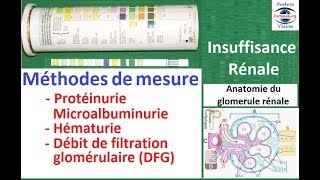 Méthodes de Mesure Protéinurie des 24h Hématurie sang dans les urines bilan urinaire [upl. by Adnak]