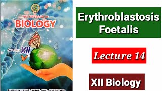 Erythroblastosis Foetalis Lecture 14 [upl. by Mylo]