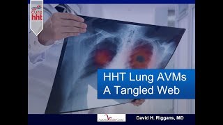 HHT Lung AVMs  A Tangled Web [upl. by Acinorahs]