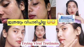 എന്നാലും നീ ആള് കൊള്ളാമല്ലോ 😳 1 Month Experience 😑Trying Viral Tretin cream 🧐 Clear Skin Rs 300 [upl. by Emlin]