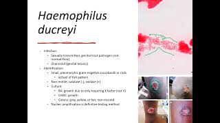 Haemophilus Legionella Bordetella amp Other Fastidous Lecture [upl. by Auhs622]