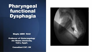 Pharyngeal Dysphagia Managing Functional Disorders [upl. by Laughlin457]