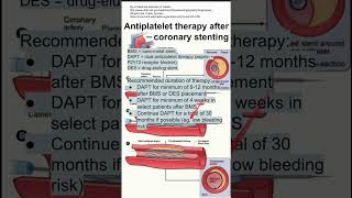 Antiplatelet therapy after coronary stenting [upl. by Burke932]