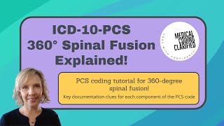 ICD10PCS 360Degree Spinal Fusion Explained [upl. by Belinda]