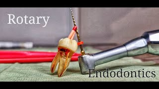 Rotary Endodontics [upl. by Ojiram]