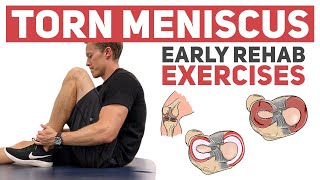 Meniscus Tear  Start With These Rehab Exercises [upl. by Ille]