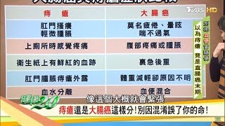 血便以為痔瘡竟是直腸癌末期！一張表告訴你兩者症狀怎麼區分 健康20 [upl. by Adnamaa]