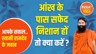 AskSwamiRamdev आंख के पास हो गए हैं सफेद निशान Swami Ramdev से जानिए कारगर इलाज [upl. by Ephram]