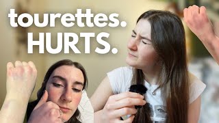 Do Tics Hurt  The Painful Reality of Tourettes [upl. by Kcirdla]