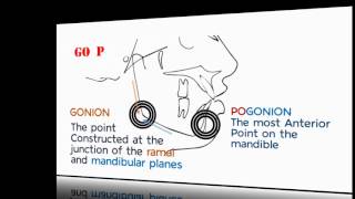 Cephalometrics Part II [upl. by Rawde]