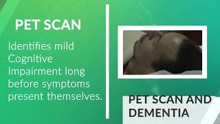 Can a PET scan detect Alzheimers Disease or Dementia [upl. by Knight]