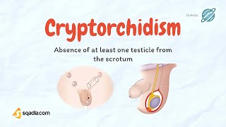 Cryptorchidism  Undescending Testicles  Causes Pathology  Pediatrics Video Lecture [upl. by Oneill]