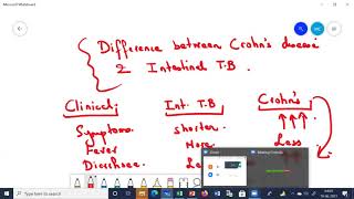 Difference between Crohns and Intestinal TB [upl. by Anaytat498]