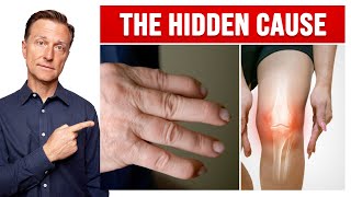 The Hidden Cause of Arthritis in Your Knees and Hands [upl. by Ban]