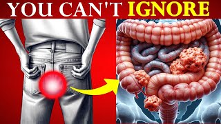 DON’T IGNORE BOWEL CANCER – 7 Symptoms That Demand URGENT Investigation [upl. by Sumaes521]