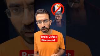 Big Brain Defect Affecting our Lives [upl. by Publias]