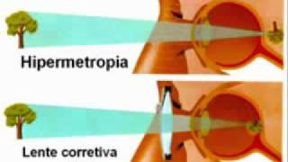 COMO FUNCIONA EL OJO HUMANO [upl. by Gerald]