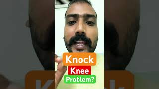 Knock ✊ Knee Problem [upl. by Nuncia]