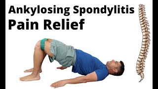 Ankylosing Spondylitis exercises for pain relief [upl. by Quin]