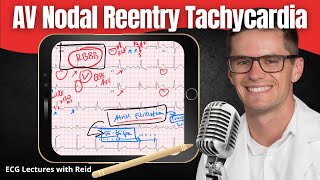 AV Nodal Reentry Tachycardia AVNRT EKG  ECG Lecture [upl. by Ynehpets813]