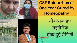 CSF Rhinorrhea of One Year Cured by Homeopathy [upl. by Jemmy]